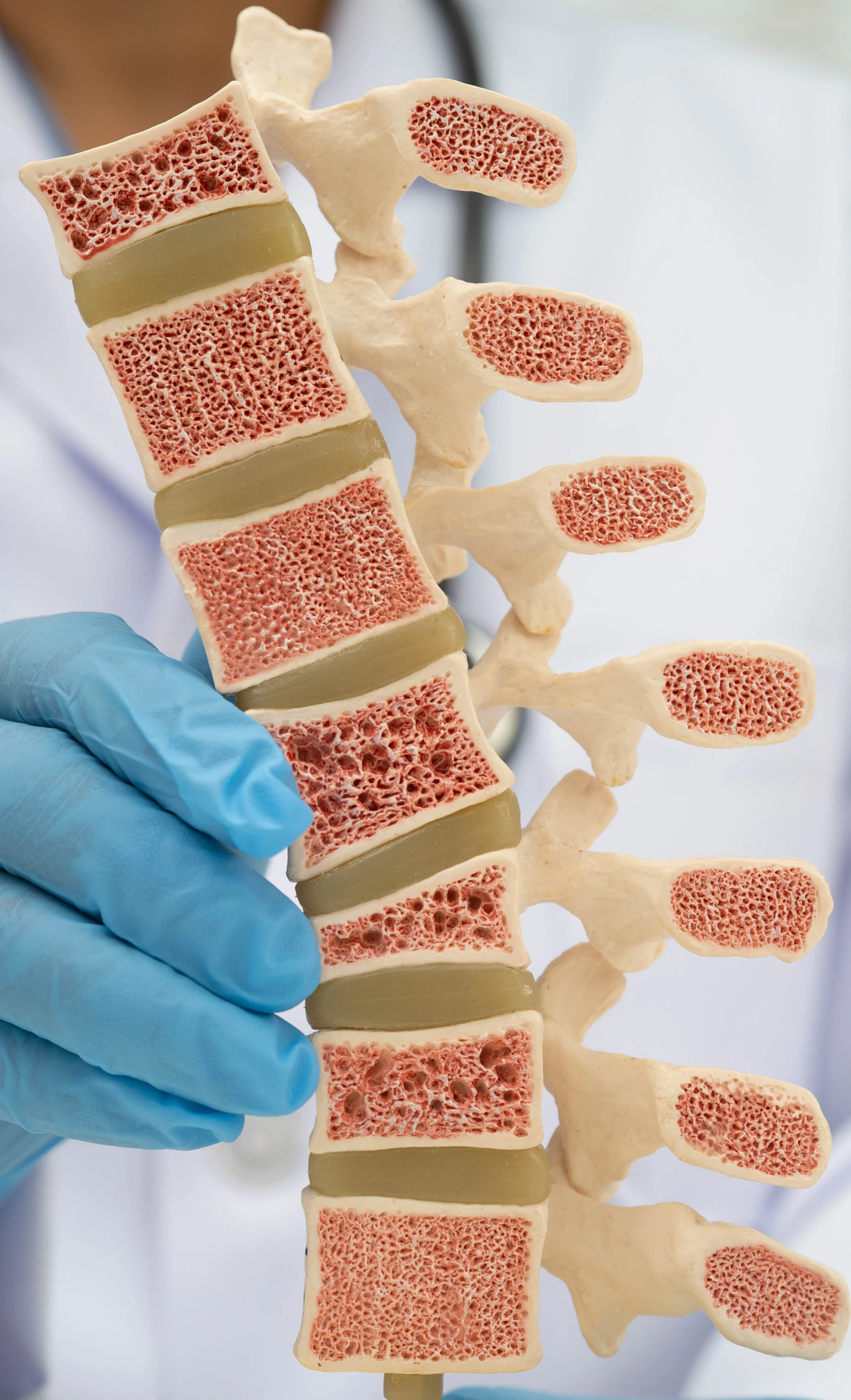Clinician in blue gloves holding an anatomical model of the spine
